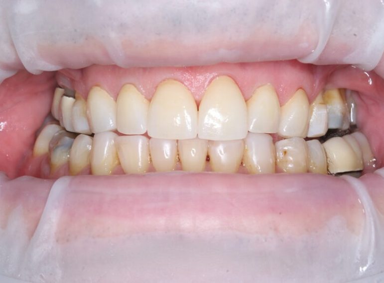 After -  Graystone Referral Centre